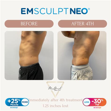 emsculpt maple valley|Medical Spa .